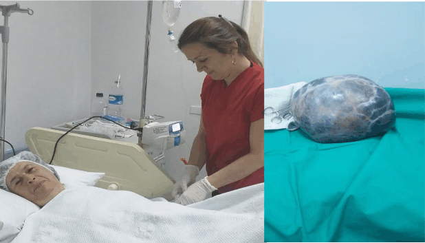 DEVLET HASTANESİNDE BAŞARILI OPERASYON
