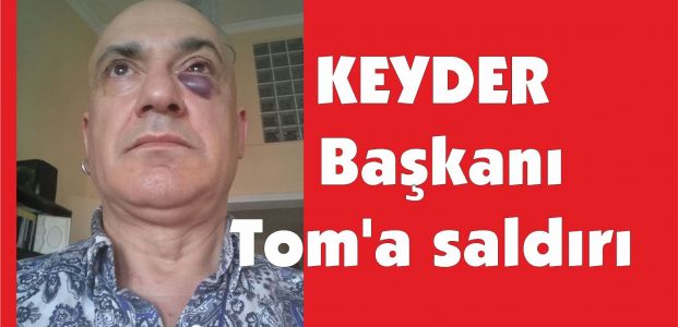 KEYDER Başkanı Tom’a saldırı