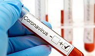 24 sağlık görevlisi koronavirüse yakalandı